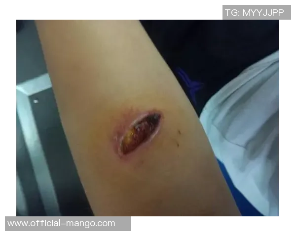 足球被狗咬事件引发的思考与讨论：宠物管理与公共安全的双重挑战